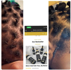 Rice Water Hair Growth Bundle | Rice Water Bundle| Beauty A New Desire